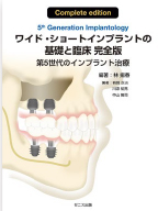 ワイド・ショートインプラントの基礎と臨床 完全版