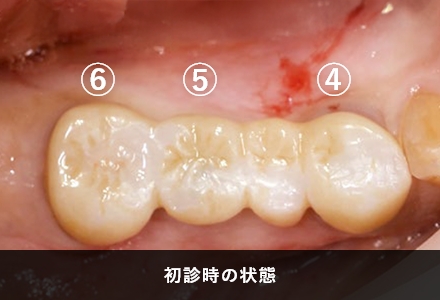 症例の概要
