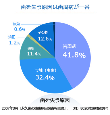 歯を失う原因は歯周病が一番